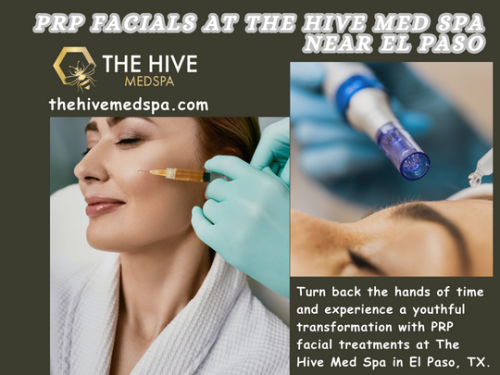 Rejuvenate-with-PRP-Facials-at-The-Hive-Med-Spa-Near-El-Paso