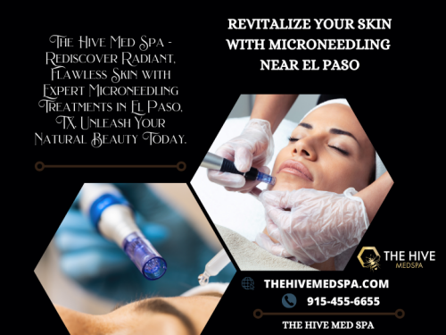 The-Hive-Med-Spa---Revitalize-Your-Skin-with-Microneedling-Near-El-Paso.png