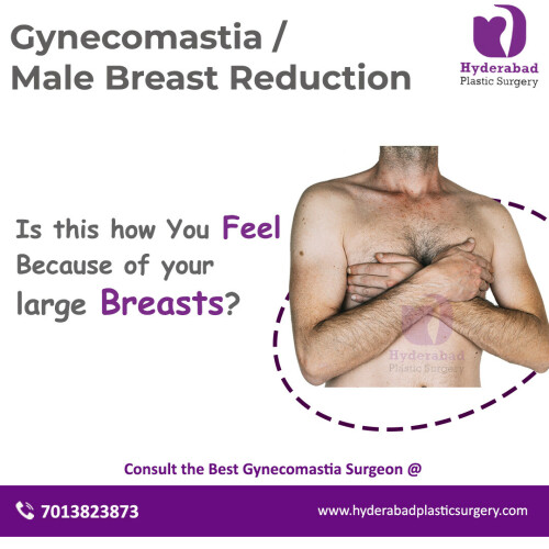 gynecomastia (2) (2)