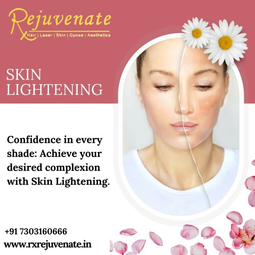 Best Bridal Facial clinic in Delhi NCR .

At RxRejuvenate, we believe that true beauty is a reflection of your inner self-confidence and well-being. Our clinic is dedicated to providing you with a personalized and transformative experience that enhances both your natural beauty and self-assurance.

Best Dermatologists Clinic In Delhi NCR - RX REJUVENATE
Website :- www.rxrejuvenate.in