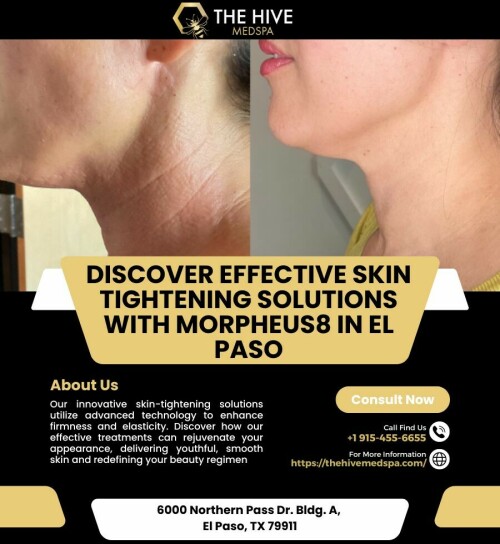 Discover Effective Skin Tightening Solutions with Morpheus8 in El Paso