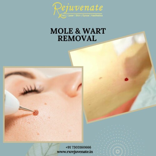 At RxRejuvenate, we believe that true beauty is a reflection of your inner self-confidence and well-being. Our clinic is dedicated to providing you with a personalized and transformative experience that enhances both your natural beauty and self-assurance.

Best Skincare Clinic In Delhi - RX REJUVENATE
Website :- www.rxrejuvenate.in