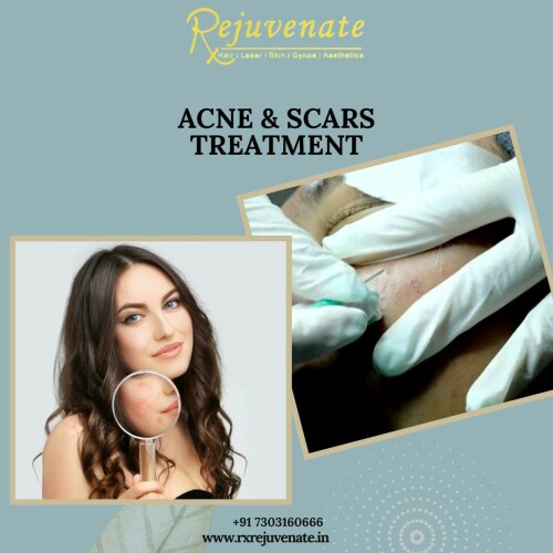 At RxRejuvenate, we believe that true beauty is a reflection of your inner self-confidence and well-being. Our clinic is dedicated to providing you with a personalized and transformative experience that enhances both your natural beauty and self-assurance.

Best Skincare Clinic In Delhi - RX REJUVENATE
Website :- www.rxrejuvenate.in