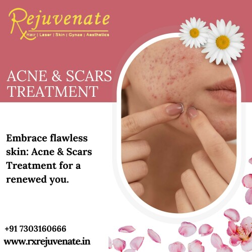 At RxRejuvenate, we believe that true beauty is a reflection of your inner self-confidence and well-being. Our clinic is dedicated to providing you with a personalized and transformative experience that enhances both your natural beauty and self-assurance.

Best Aesthetic Clinic In Delhi NCR - RX REJUVENATE
Website :- www.rxrejuvenate.in