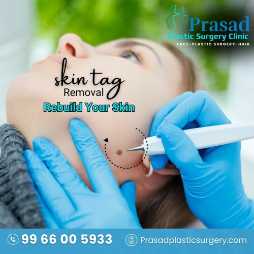 Prasad plastic surgery