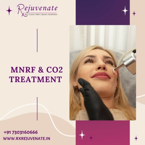 At RxRejuvenate, we believe that true beauty is a reflection of your inner self-confidence and well-being. Our clinic is dedicated to providing you with a personalized and transformative experience that enhances both your natural beauty and self-assurance.

Best Dermatologist in Delhi NCR- RX REJUVENATE
Website :- www.rxrejuvenate.in