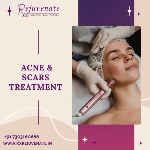 At RxRejuvenate, we believe that true beauty is a reflection of your inner self-confidence and well-being. Our clinic is dedicated to providing you with a personalized and transformative experience that enhances both your natural beauty and self-assurance.

Best Dermatologist in Delhi NCR- RX REJUVENATE
Website :- www.rxrejuvenate.in