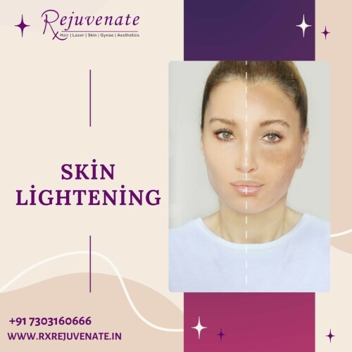 At RxRejuvenate, we believe that true beauty is a reflection of your inner self-confidence and well-being. Our clinic is dedicated to providing you with a personalized and transformative experience that enhances both your natural beauty and self-assurance.

Best Dermatologist in Delhi NCR- RX REJUVENATE
Website :- www.rxrejuvenate.in