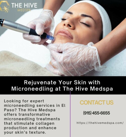 Rejuvenate-Your-Skin-with-Microneedling-at-The-Hive-Medspa.jpeg