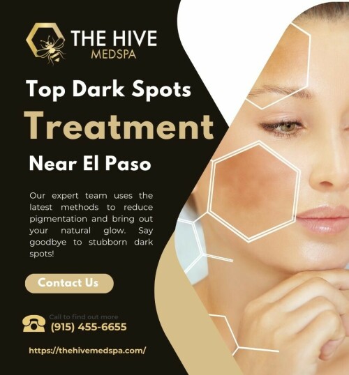 Top-Dark-Spots-Treatment-Near-You--Clearer-Brighter-Skin-Awaits-at-The-Hive-Medspa.jpeg