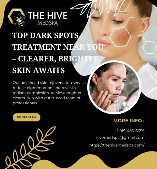 Top-Dark-Spots-Treatment-Near-You--Clearer-Brighter-Skin-Awaits-at-The-Hive-Medspa.jpeg