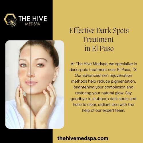 Effective-Dark-Spots-Treatment-in-El-Paso.jpeg